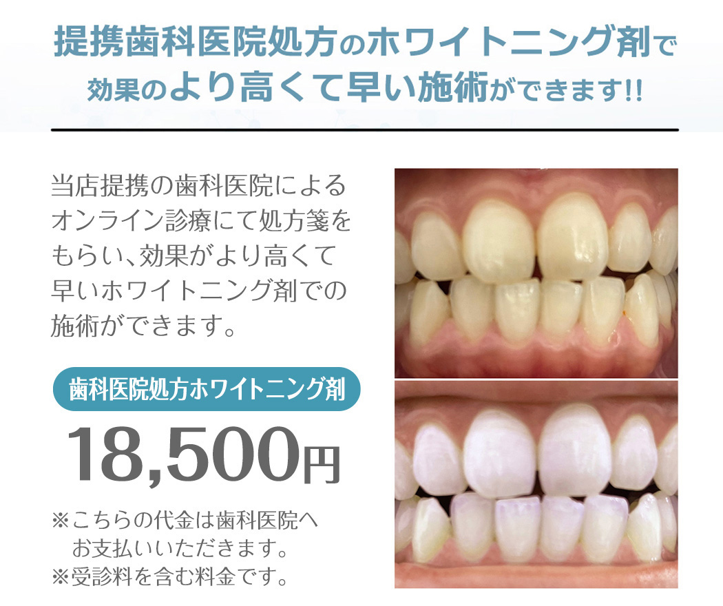 提携歯科医院処方のホワイトニングジェル